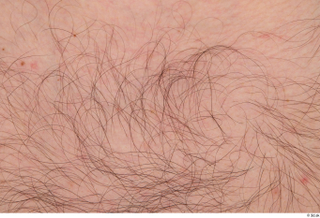 Turgen hairy nude skin 0003.jpg